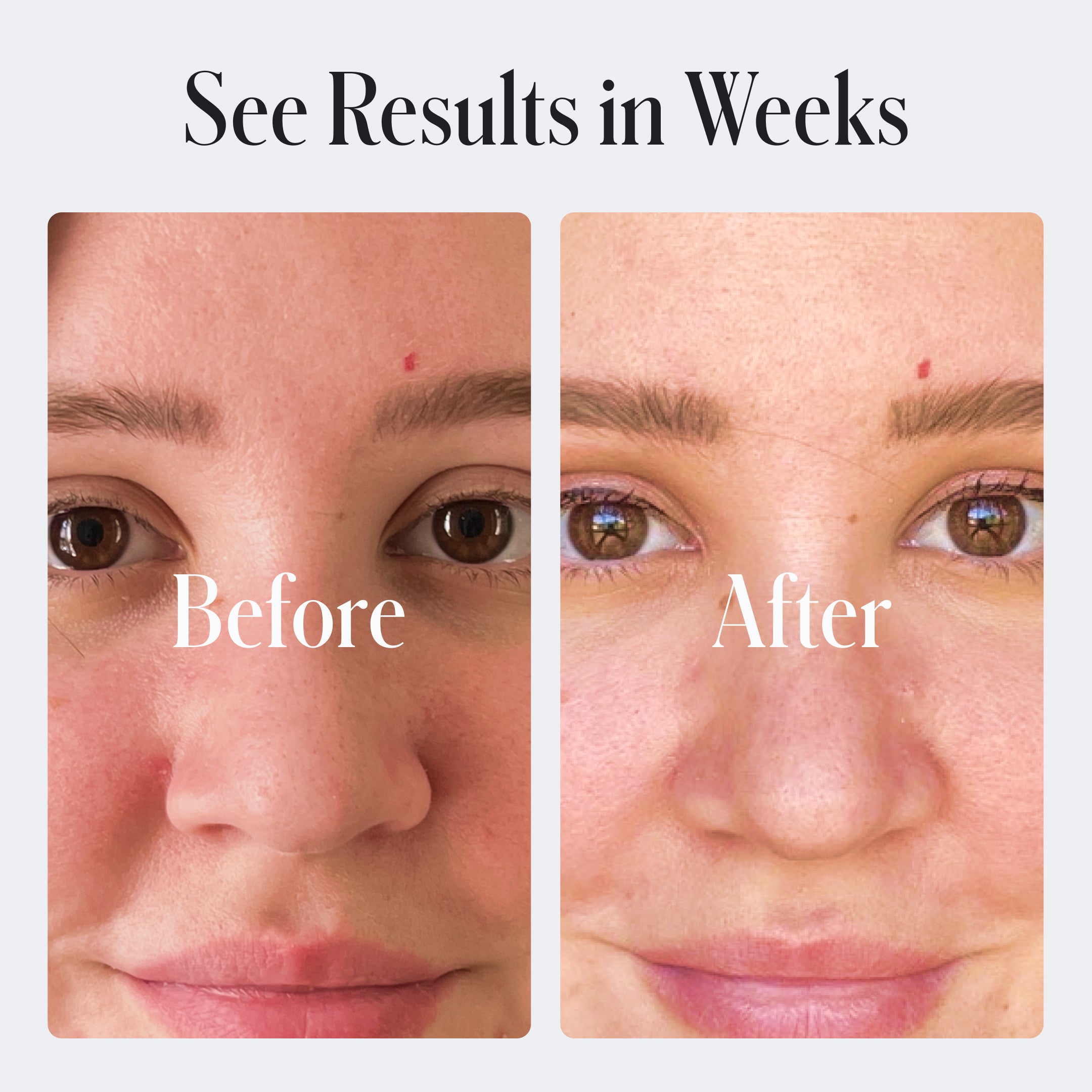 Acne Control Face Wash